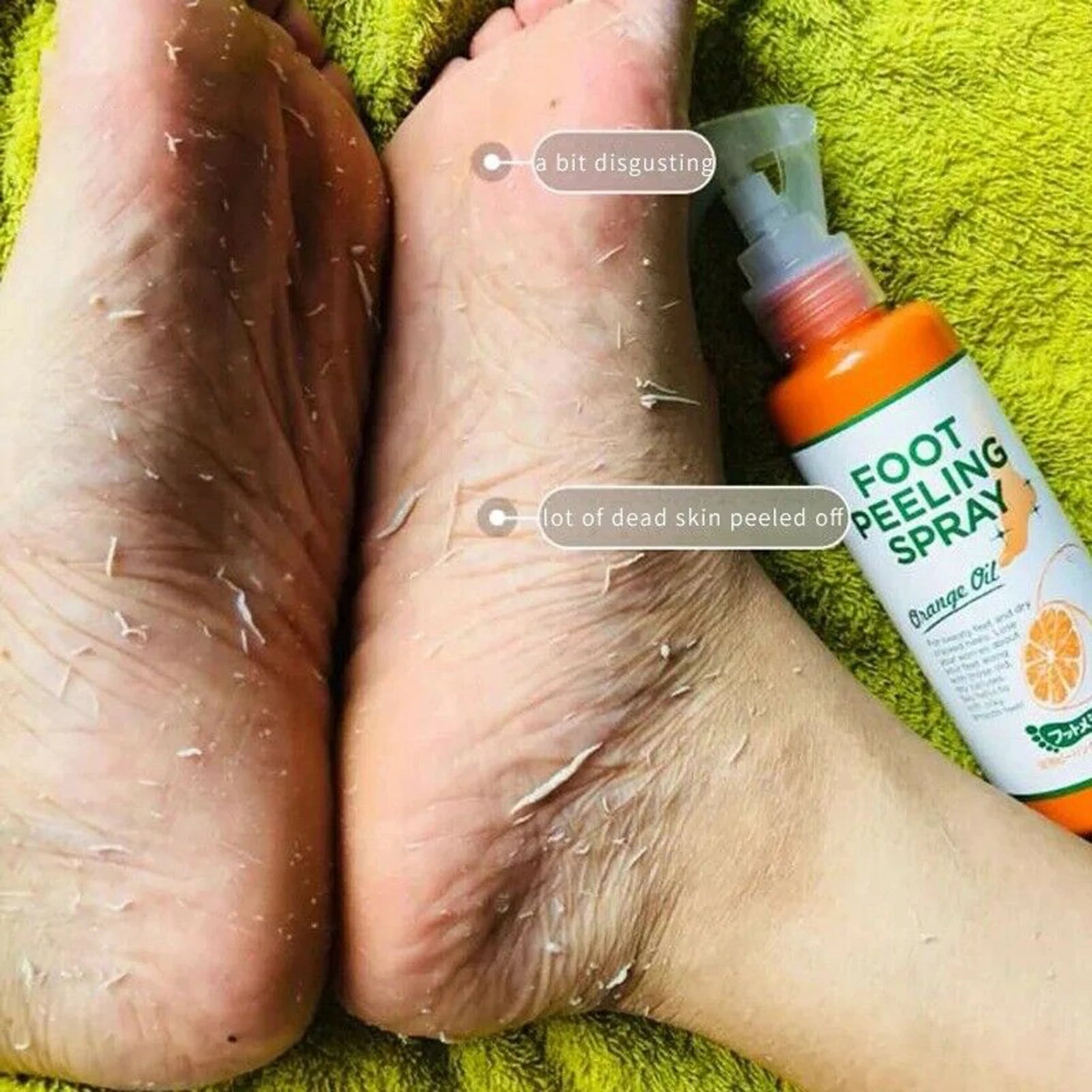 Foot Cuticle & Callus Remover Oppyi