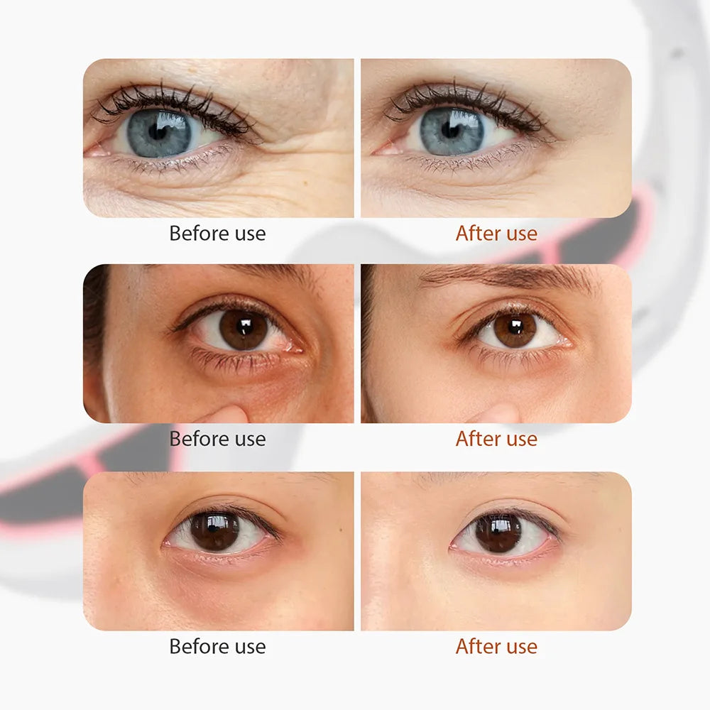 Eye Massager Under Eye Red Light Therapy Glasses, Red Light Therapy Device Microcurrent Reduce Dark Circles and Wrinkles Oppyi